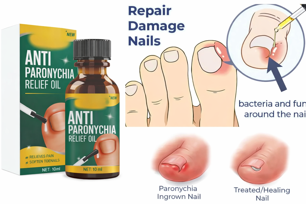 Anti Paronychia Relief Oil- Buy 1 get 1